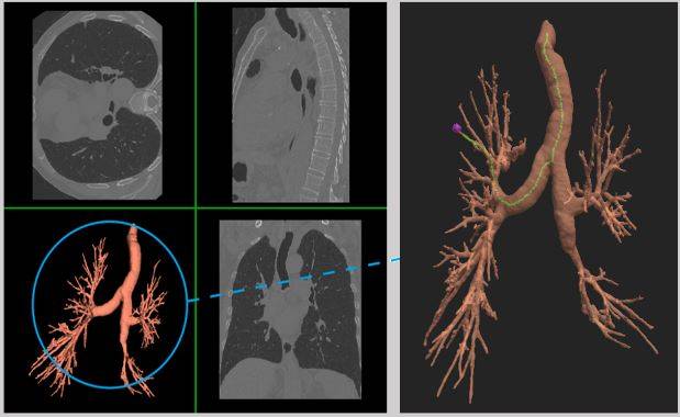 Interactive and Augmented Modelling